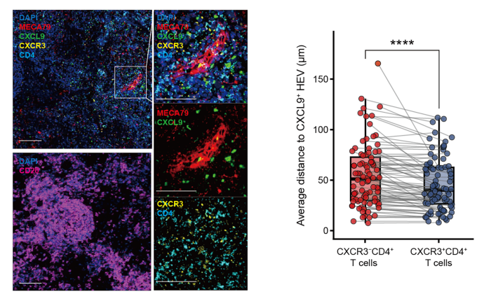 我科学家发现鼻咽癌关键疗效预测标志物